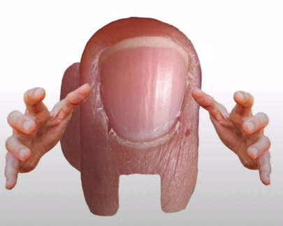 among us toe